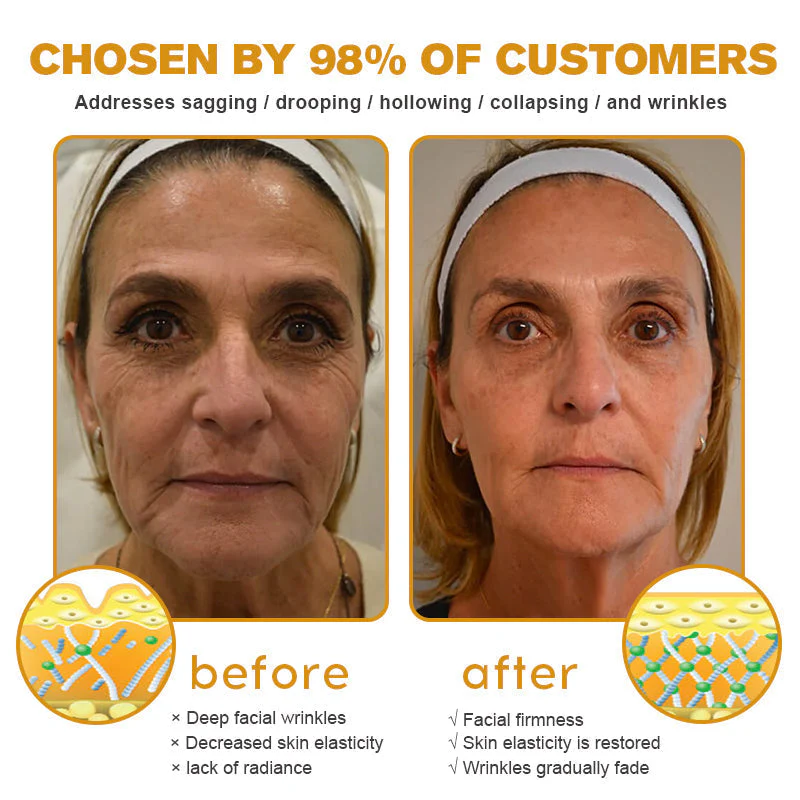 👨⚕️ Made and Shipped from US✅ Tlopa® Bee Venom Multi-Symptom Skin Treatment Cream