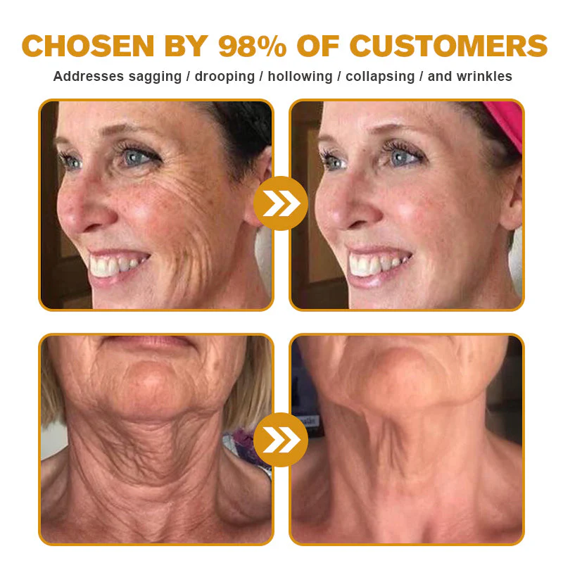 👨⚕️ Made and Shipped from US✅ Tlopa® Bee Venom Multi-Symptom Skin Treatment Cream