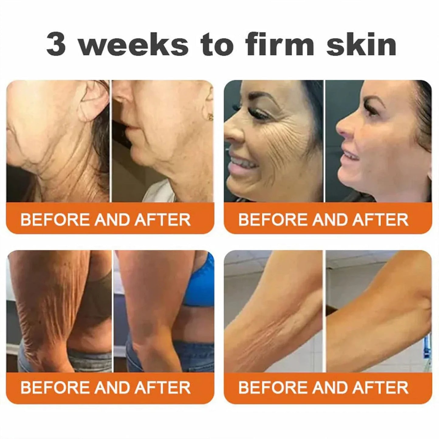 👨‍⚕️ Made and Shipped from US✅ Tlopa® Bee Venom Multi-Symptom Skin Treatment Cream